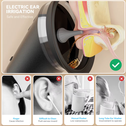 Nettoyeur d’Oreilles Électrique